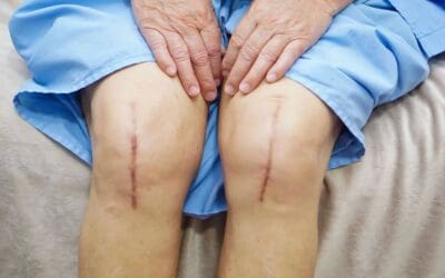 🏃‍♂️ Mike Rilstone: Hey Fellow Seniors: What’s More Important, Your Knees or Running?