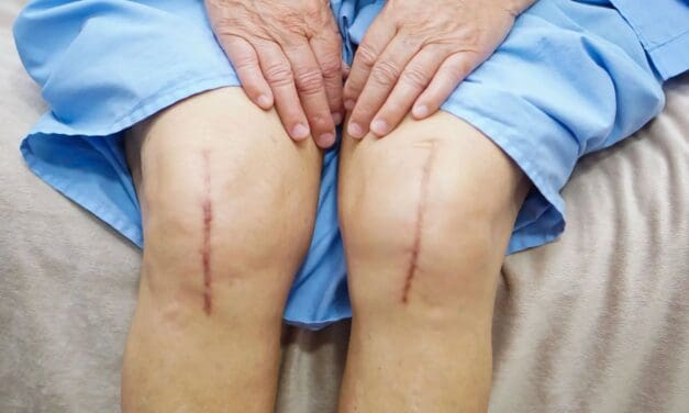 🏃‍♂️ Mike Rilstone: Hey Fellow Seniors: What’s More Important, Your Knees or Running?